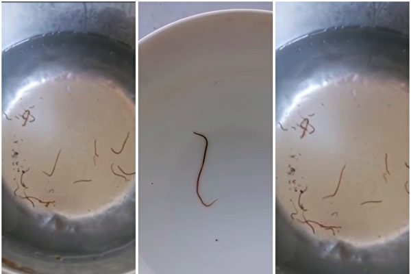 7-year-old child in Yunnan struggles to breathe, coughs up a leech